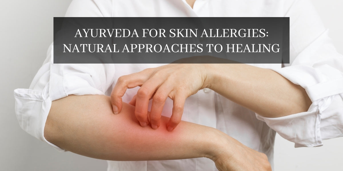 Ayurveda for Skin Allergies Natural Approaches to Healing Santhigram